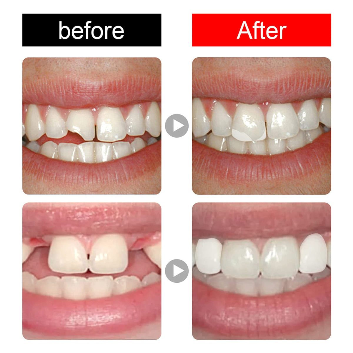 168 Pieces Acrylic Resin Denture Teeth 6 Sets 23 Shade A2 Upper + Lower B768